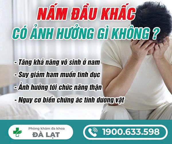 Hình ảnh minh họa